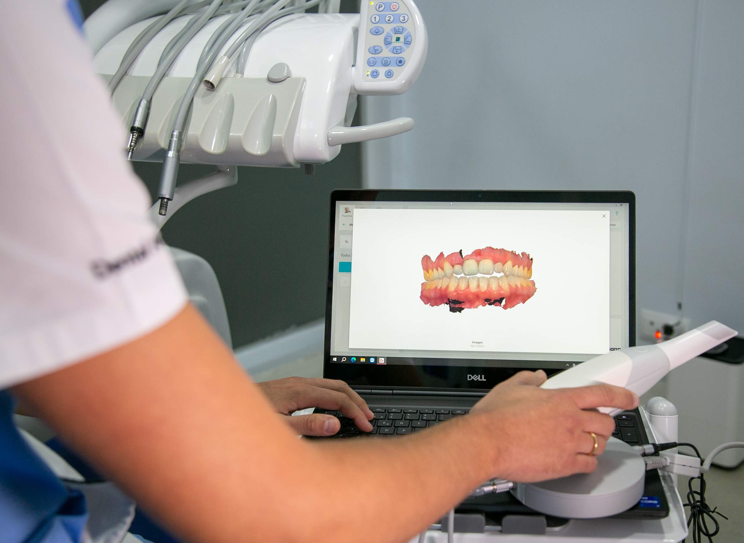 Estética dental en Barajas